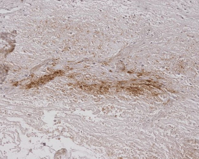 Alginate Antibody in Immunohistochemistry (IHC)
