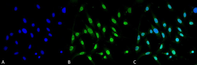 GRP78 Antibody in Immunocytochemistry (ICC/IF)