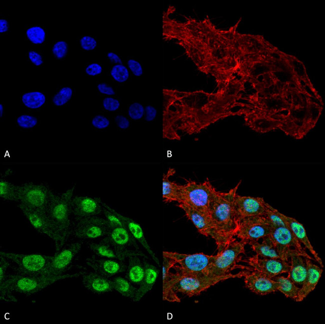 DNMT1 Antibody in Immunocytochemistry (ICC/IF)