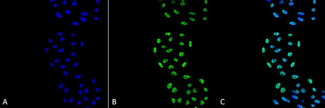 PP5 Antibody in Immunocytochemistry (ICC/IF)
