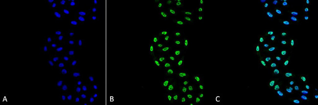 PP5 Antibody in Immunocytochemistry (ICC/IF)