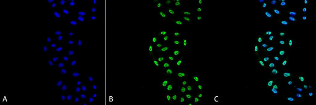 PP5 Antibody in Immunocytochemistry (ICC/IF)