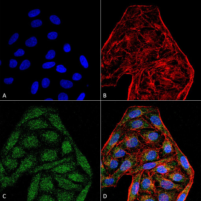 CD74 Antibody in Immunocytochemistry (ICC/IF)