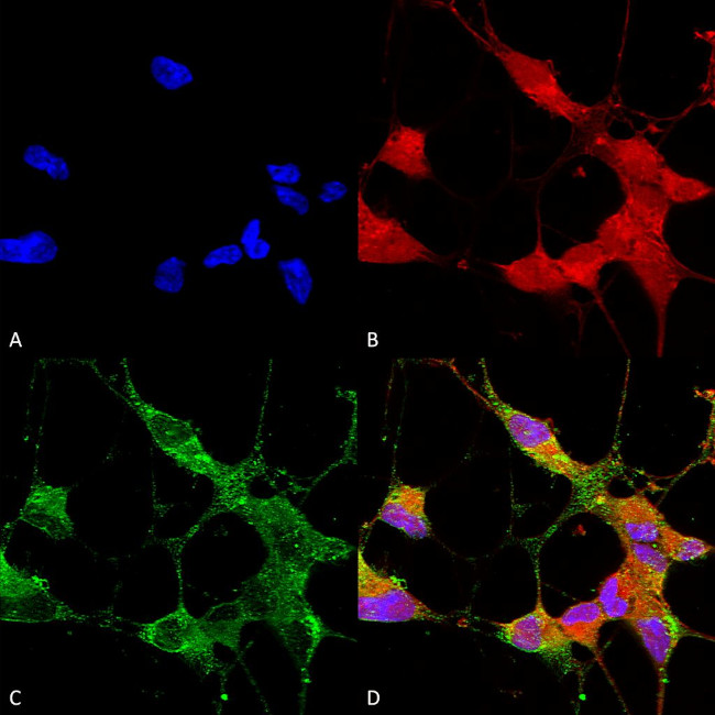 TRPC5 Antibody in Immunocytochemistry (ICC/IF)