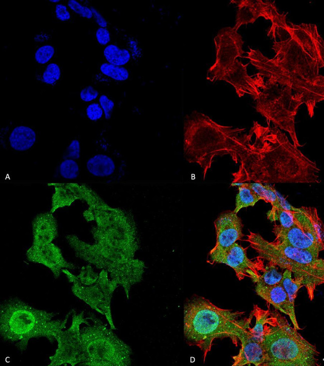 GFAP Antibody in Immunocytochemistry (ICC/IF)