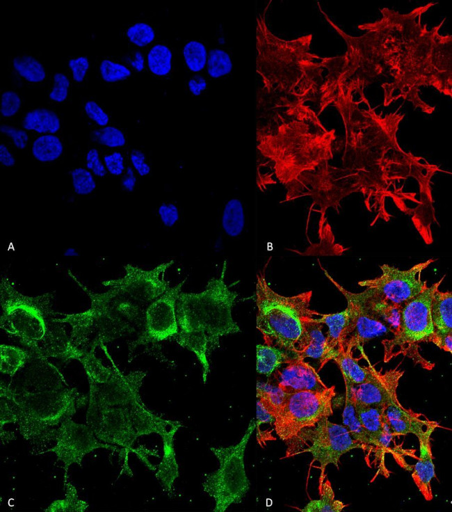 GFAP Antibody in Immunocytochemistry (ICC/IF)