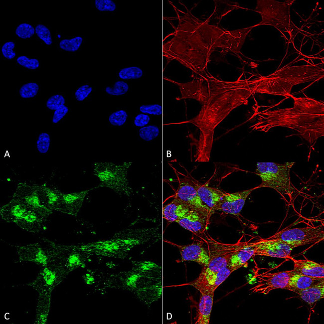 VDAC Antibody in Immunocytochemistry (ICC/IF)