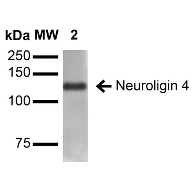 NLGN4X (Neuroligin-4) Antibody in Western Blot (WB)