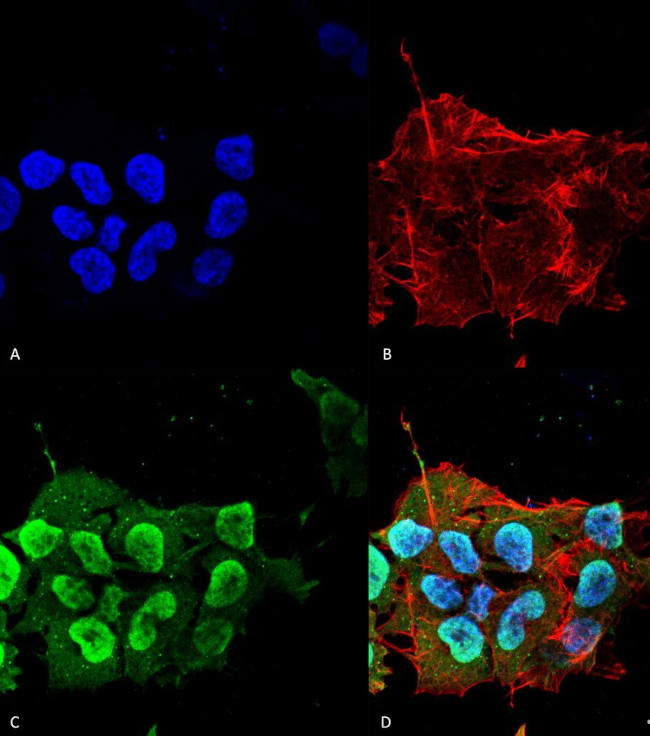 Ataxin 1 Antibody in Immunocytochemistry (ICC/IF)