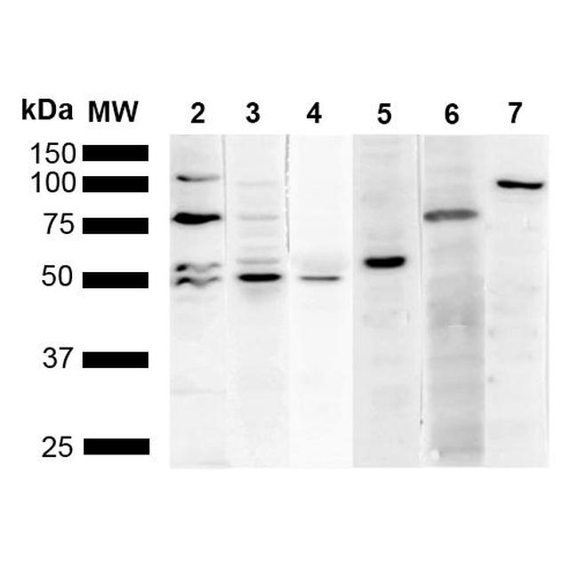 KDEL Antibody in Western Blot (WB)