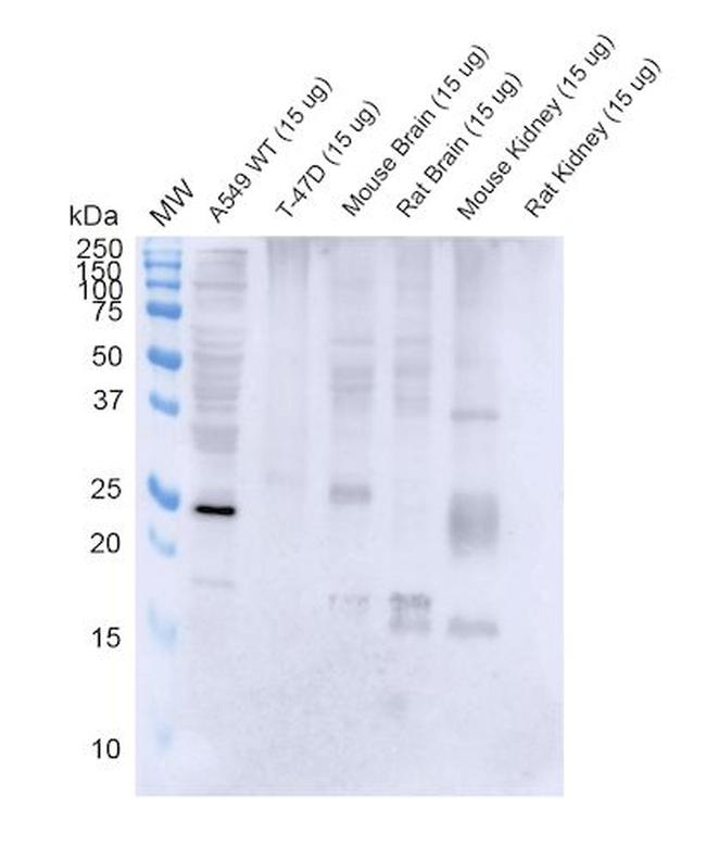 RAB3D Antibody in Western Blot (WB)
