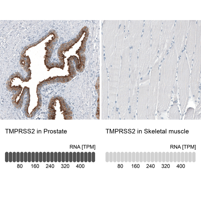 TMPRSS2 Antibody in Immunohistochemistry (Paraffin) (IHC (P))