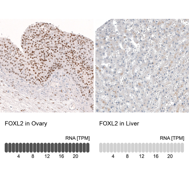 FOXL2 Antibody in Immunohistochemistry (Paraffin) (IHC (P))