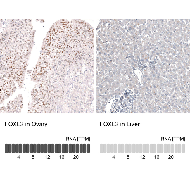 FOXL2 Antibody in Immunohistochemistry (Paraffin) (IHC (P))
