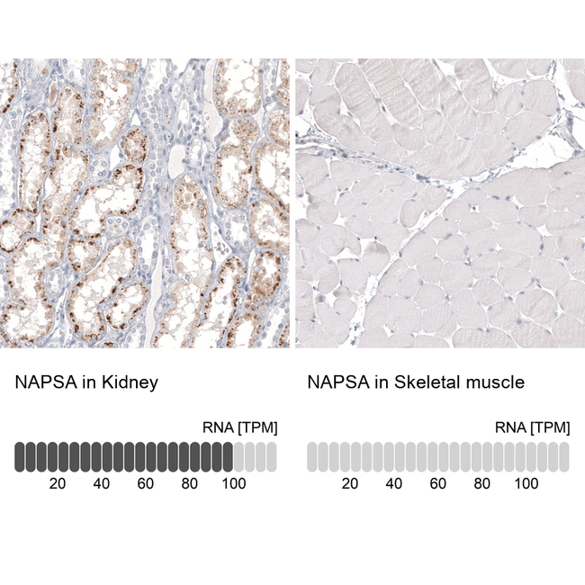 NAPSA Antibody in Immunohistochemistry (Paraffin) (IHC (P))