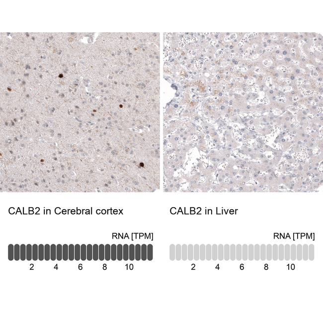 Calretinin Antibody in Immunohistochemistry (Paraffin) (IHC (P))