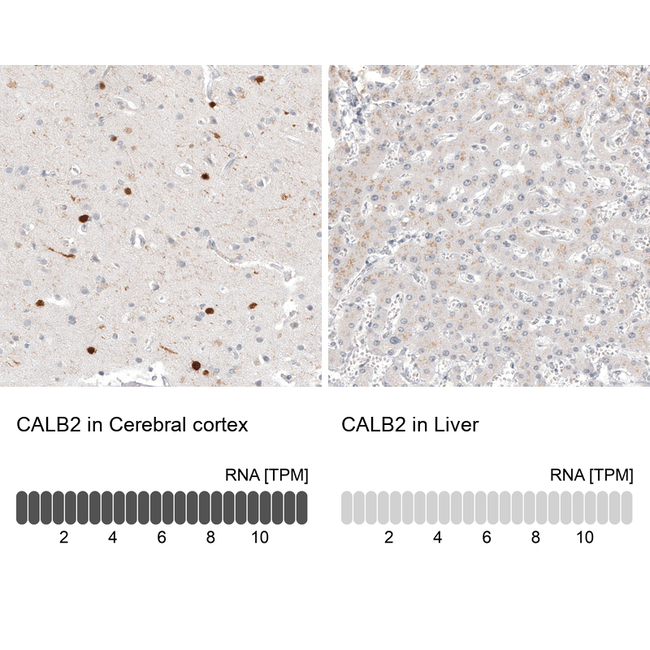 Calretinin Antibody in Immunohistochemistry (Paraffin) (IHC (P))