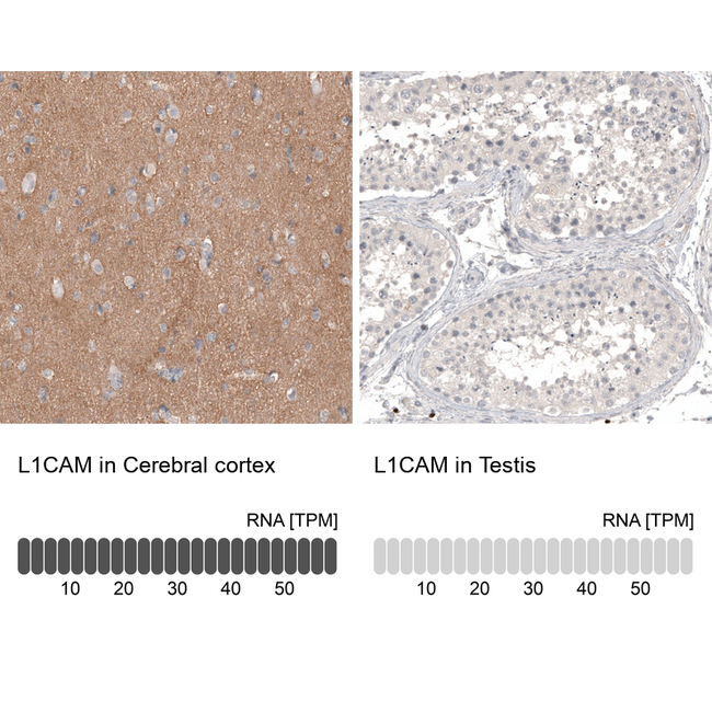 CD171 (L1CAM) Antibody in Immunohistochemistry (Paraffin) (IHC (P))