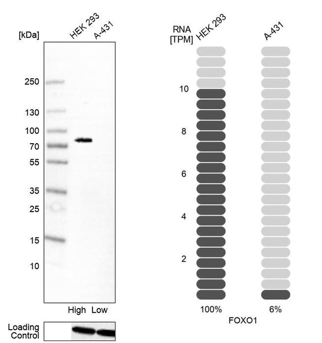 FOXO1 Antibody in Western Blot (WB)