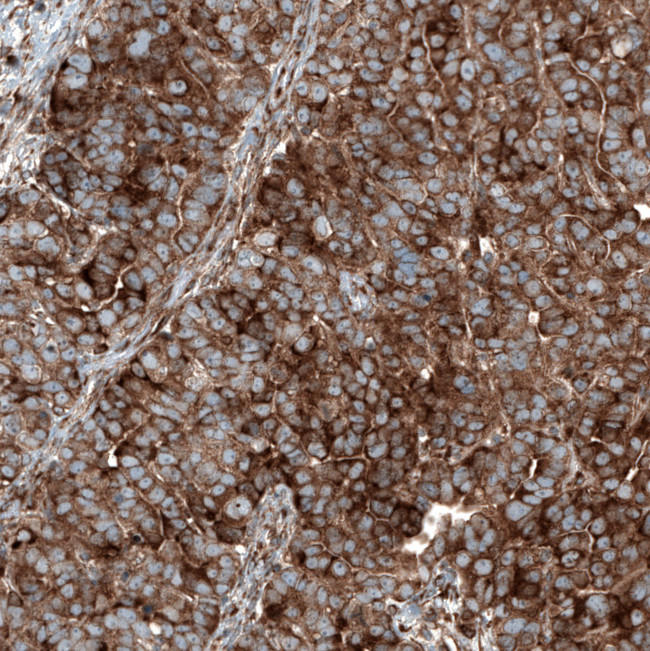 GSPT1 Antibody in Immunohistochemistry (Paraffin) (IHC (P))