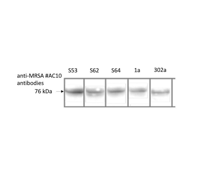 Staphylococcus aureus PBP2a (Methicillin-resistant) Antibody in Western Blot (WB)