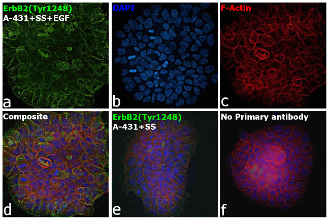 Phospho-ErbB2 (HER-2) (Tyr1248) Antibody in Immunocytochemistry (ICC/IF)