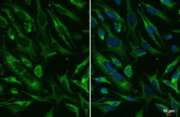SDHA Antibody in Immunocytochemistry (ICC/IF)