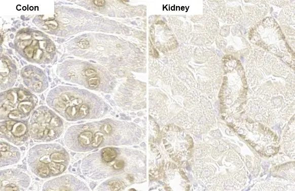 PARP14 Antibody in Immunohistochemistry (Paraffin) (IHC (P))