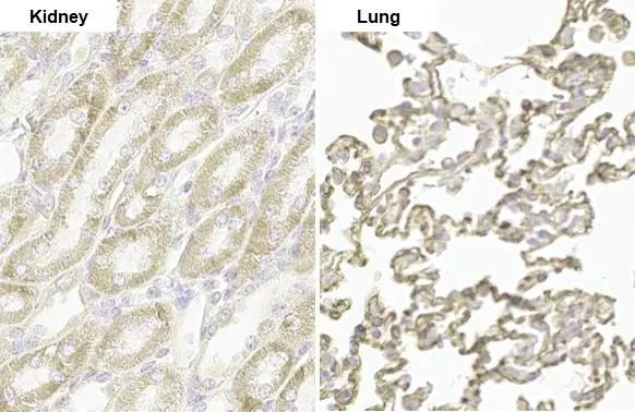PARP14 Antibody in Immunohistochemistry (Paraffin) (IHC (P))