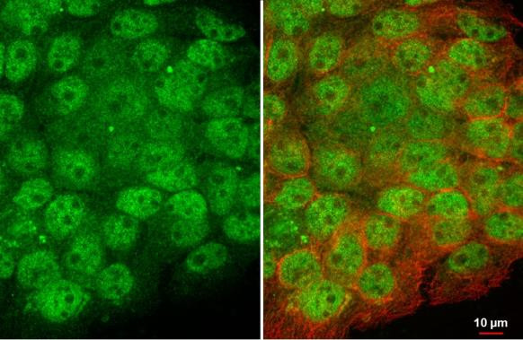 Artemis Antibody in Immunocytochemistry (ICC/IF)