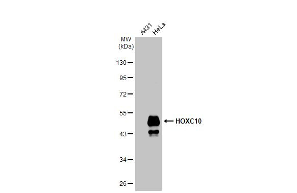 HOXC10 Antibody in Western Blot (WB)