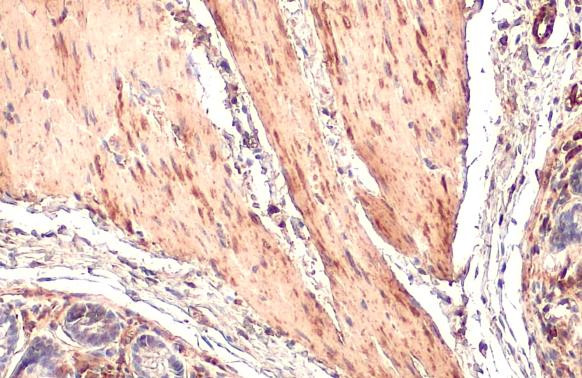 TAGLN Antibody in Immunohistochemistry (Paraffin) (IHC (P))