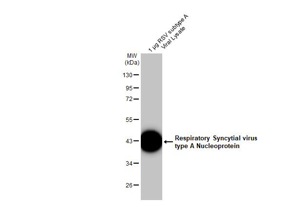 RSV Type A NP Antibody in Western Blot (WB)