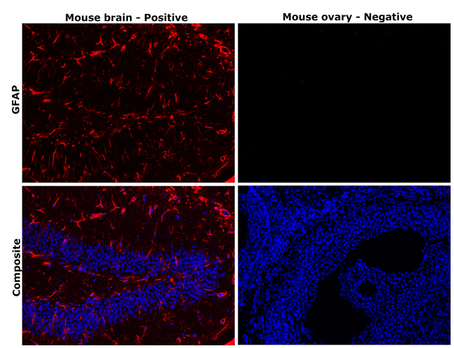 GFAP Antibody in Immunohistochemistry (Paraffin) (IHC (P))