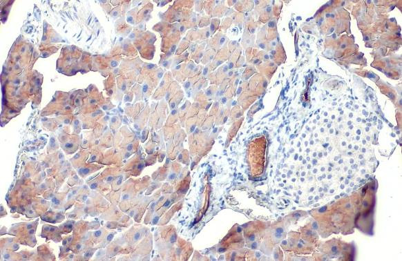 PNLIP Antibody in Immunohistochemistry (Paraffin) (IHC (P))