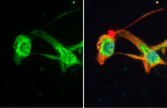 C2orf33 Antibody in Immunocytochemistry (ICC/IF)