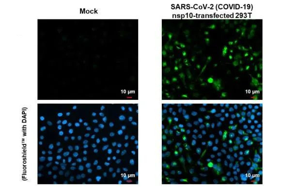 SARS-CoV-2 NSP10 Antibody in Immunocytochemistry (ICC/IF)
