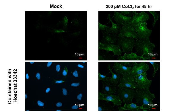 Carbonic Anhydrase IX Antibody in Immunocytochemistry (ICC/IF)