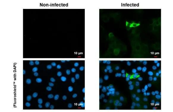 Chikungunya Virus NSP2 Antibody in Immunocytochemistry (ICC/IF)