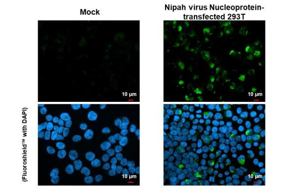 Nipah Virus Nucleoprotein Antibody in Immunocytochemistry (ICC/IF)