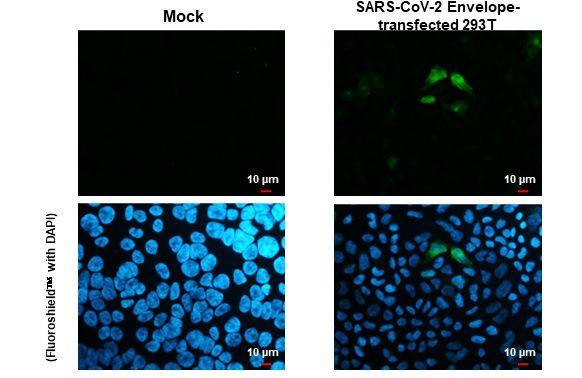 SARS-CoV-2 Envelope Antibody in Immunocytochemistry (ICC/IF)