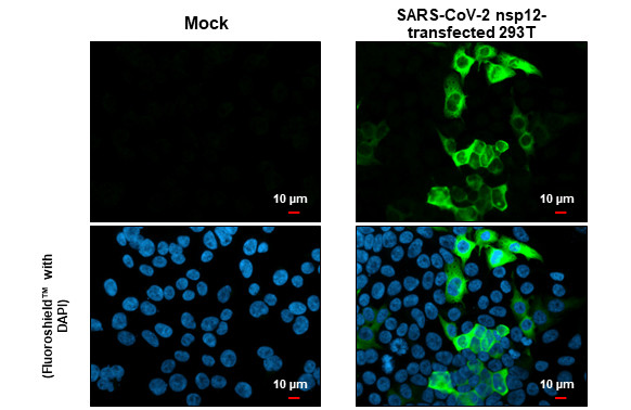 SARS-CoV-2 NSP12 Antibody in Immunocytochemistry (ICC/IF)