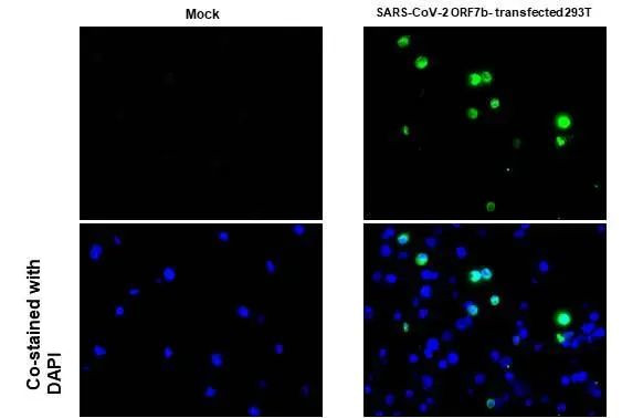 SARS-CoV-2 ORF7b Antibody in Immunocytochemistry (ICC/IF)