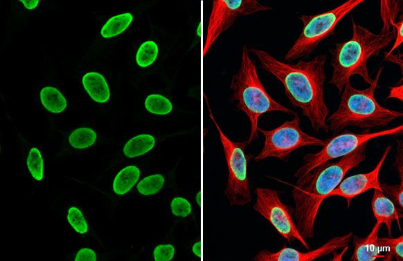 H3K18ac Antibody in Immunocytochemistry (ICC/IF)