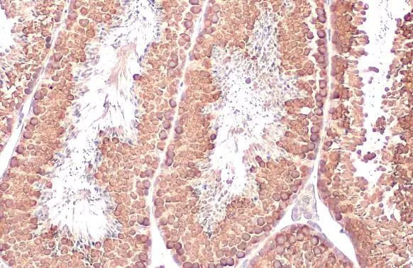 DDX4 Antibody in Immunohistochemistry (Paraffin) (IHC (P))