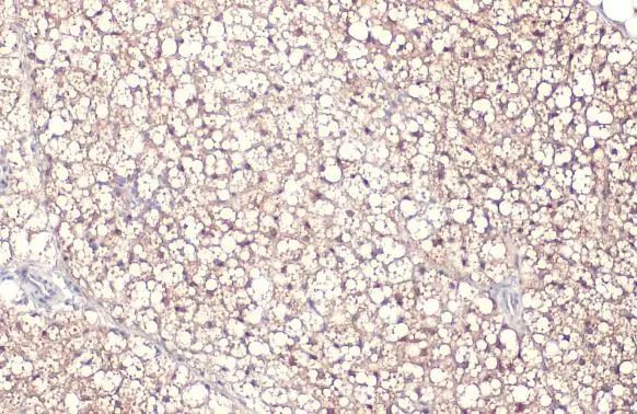 FABP4 Antibody in Immunohistochemistry (Paraffin) (IHC (P))