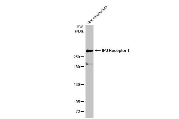 Ip3 Str IP3 Receptor 1 Recombinant Rabbit Monoclonal Antibody (HL1541 ...