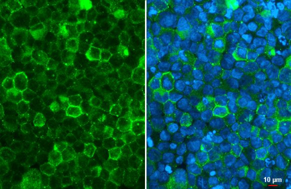 TRPV2 Antibody in Immunocytochemistry (ICC/IF)
