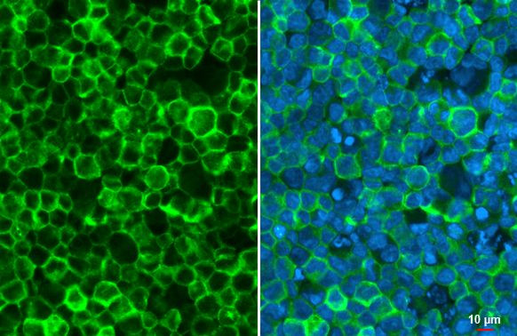 TRPV2 Antibody in Immunocytochemistry (ICC/IF)