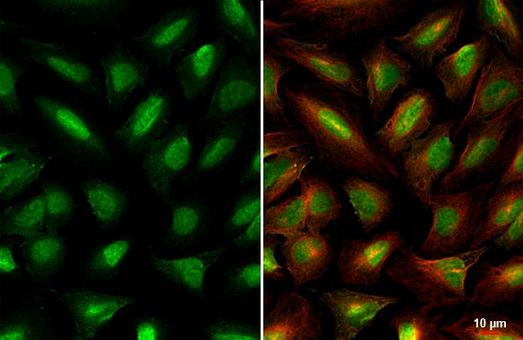 ZBTB17 Antibody in Immunocytochemistry (ICC/IF)